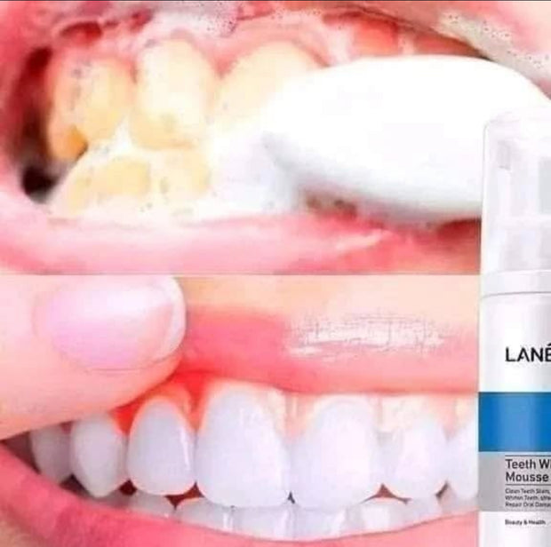 Teeth Whitening Mousse